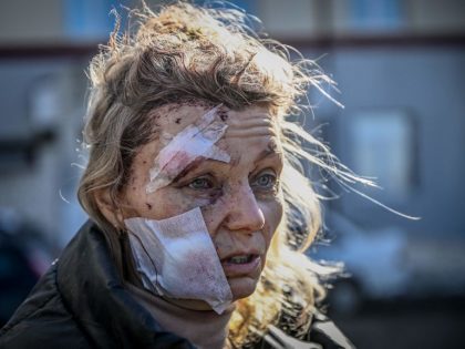 TOPSHOT-UKRAINE-RUSSIA-CONFLICT