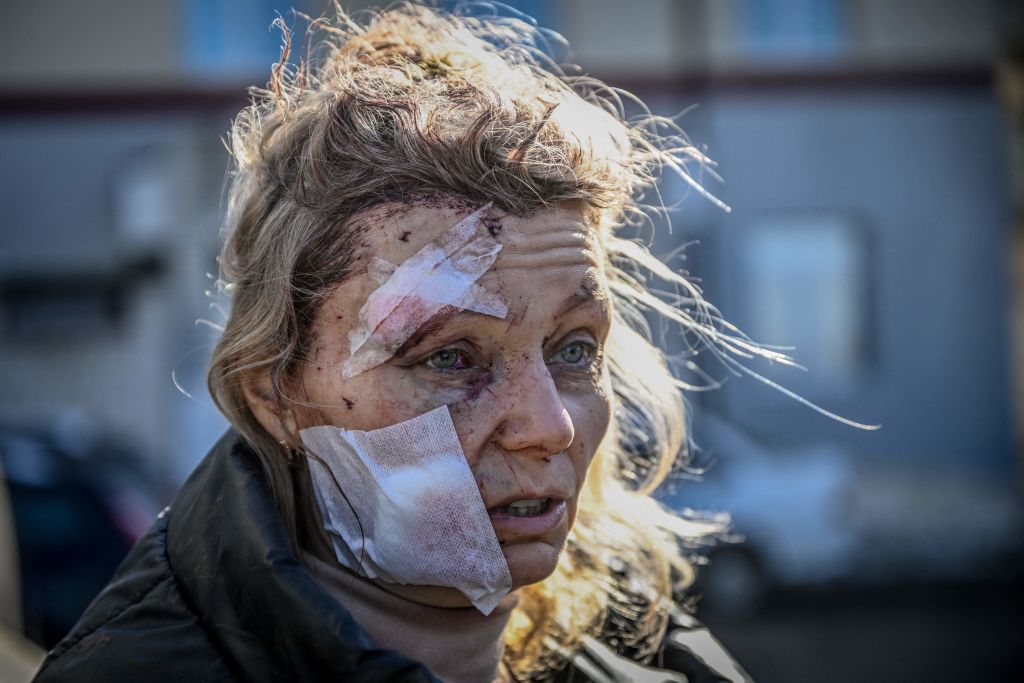 TOPSHOT-UKRAINE-RUSSIA-CONFLICT
