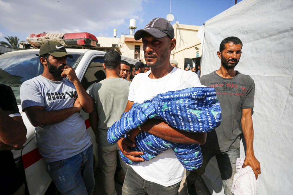 7 month old baby died due to malnutrition in Gaza under Israeli attacks