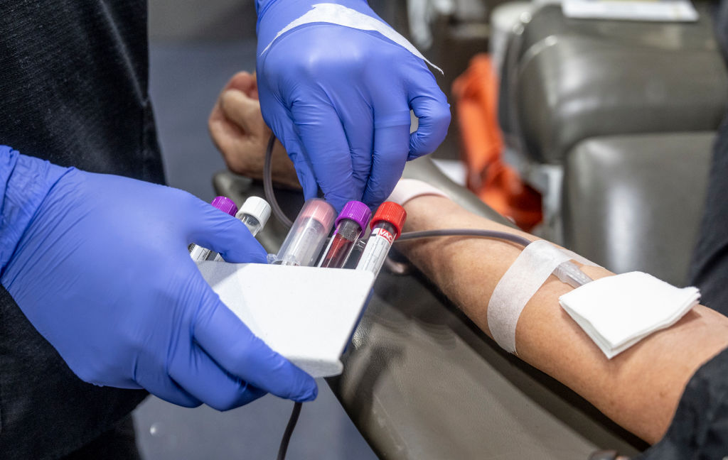 An arm outstretched with two gloved hands holding blood viles next to an IV in the arm.