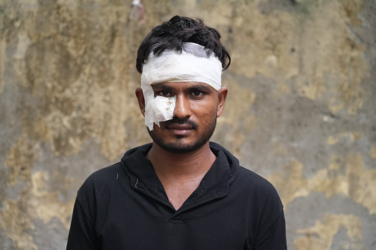 Injured student activist Aniket Patel